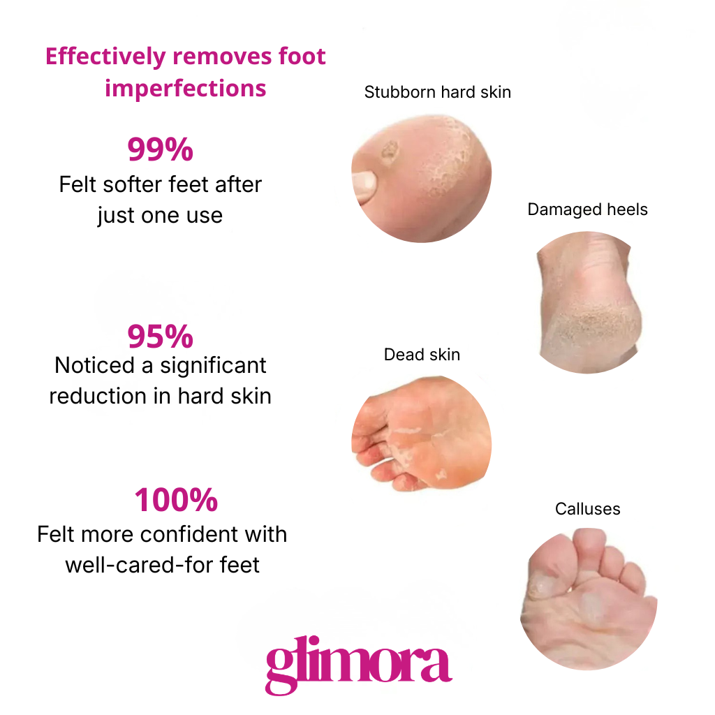 ROSE RITUAL™ — THE SOFT FEET RITUAL