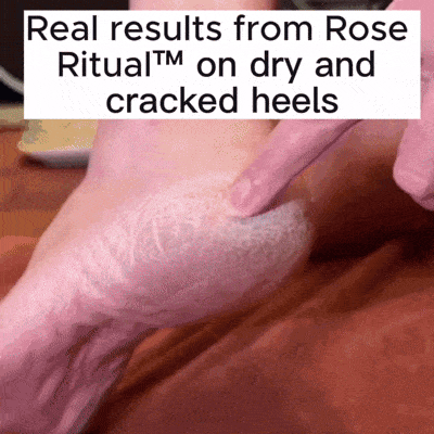 ROSE RITUAL™ — THE SOFT FEET RITUAL